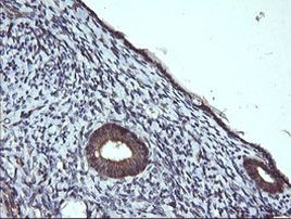PTPRC Antibody in Immunohistochemistry (Paraffin) (IHC (P))