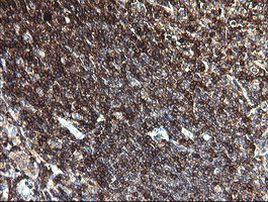 PTPRC Antibody in Immunohistochemistry (Paraffin) (IHC (P))