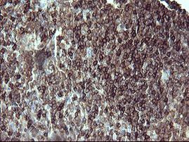 PTPRC Antibody in Immunohistochemistry (Paraffin) (IHC (P))