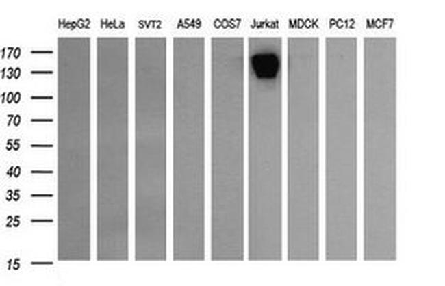 PTPRC Antibody in Western Blot (WB)