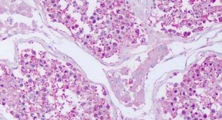 PTPRE Antibody in Immunohistochemistry (Paraffin) (IHC (P))