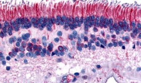 PTPRM Antibody in Immunohistochemistry (Paraffin) (IHC (P))