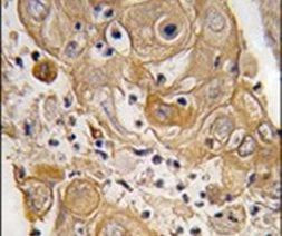 PTRF Antibody in Immunohistochemistry (IHC)