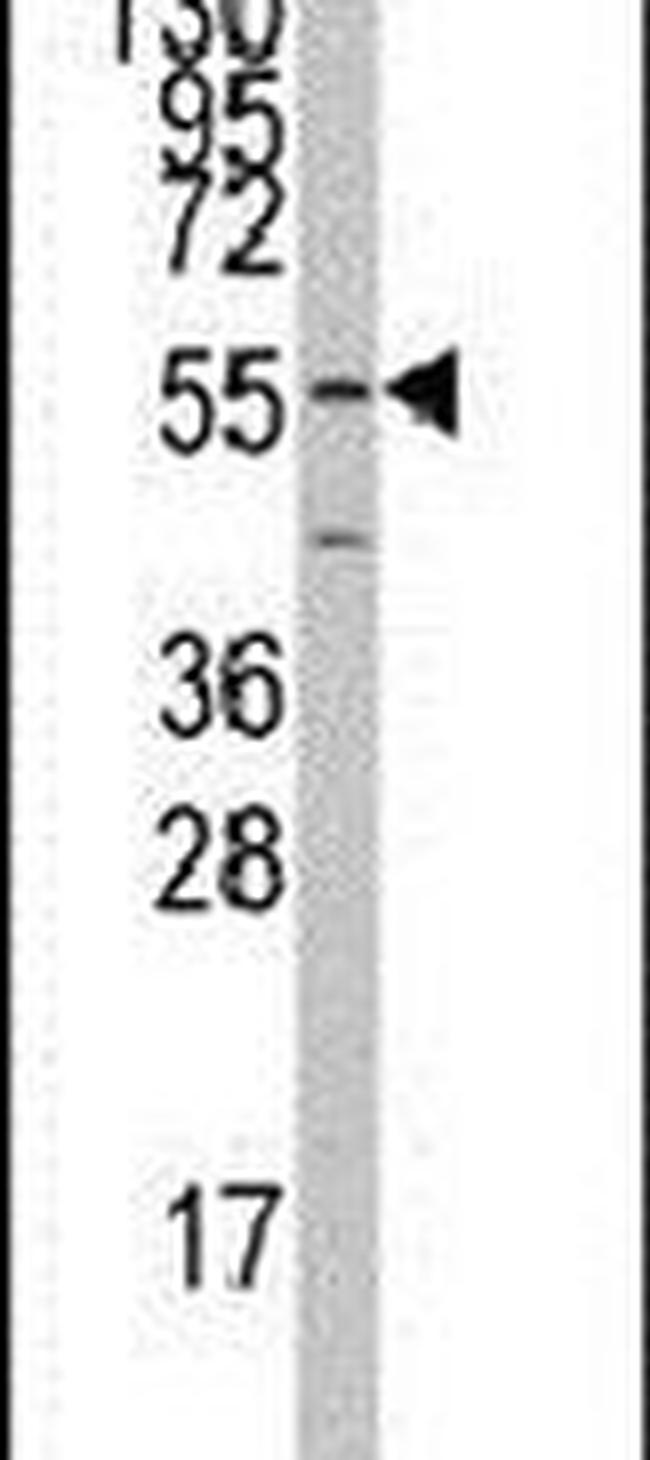 PTRF Antibody in Western Blot (WB)