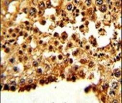 Securin Antibody in Immunohistochemistry (IHC)