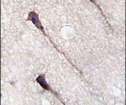 PUM1 Antibody in Immunohistochemistry (IHC)