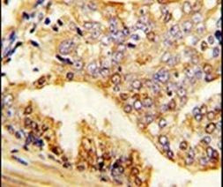 PUM2 Antibody in Immunohistochemistry (IHC)