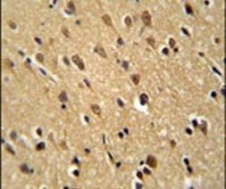 PFAS Antibody in Immunohistochemistry (IHC)