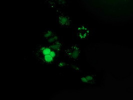 PUS7 Antibody in Immunocytochemistry (ICC/IF)