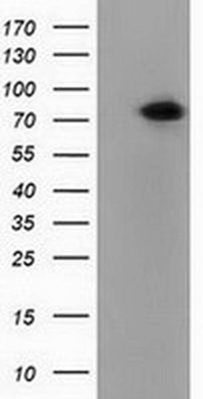PUS7 Antibody in Western Blot (WB)