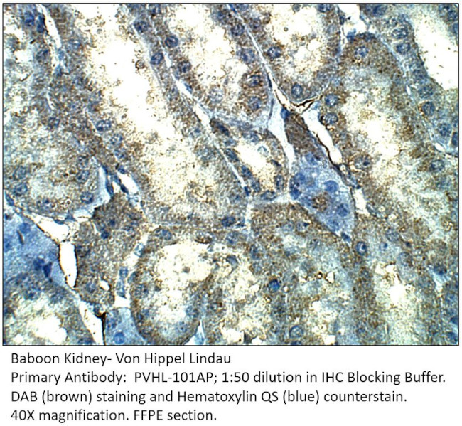 Von Hippel Lindau Antibody in Immunohistochemistry (IHC)