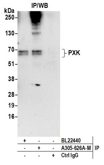 PXK Antibody in Immunoprecipitation (IP)