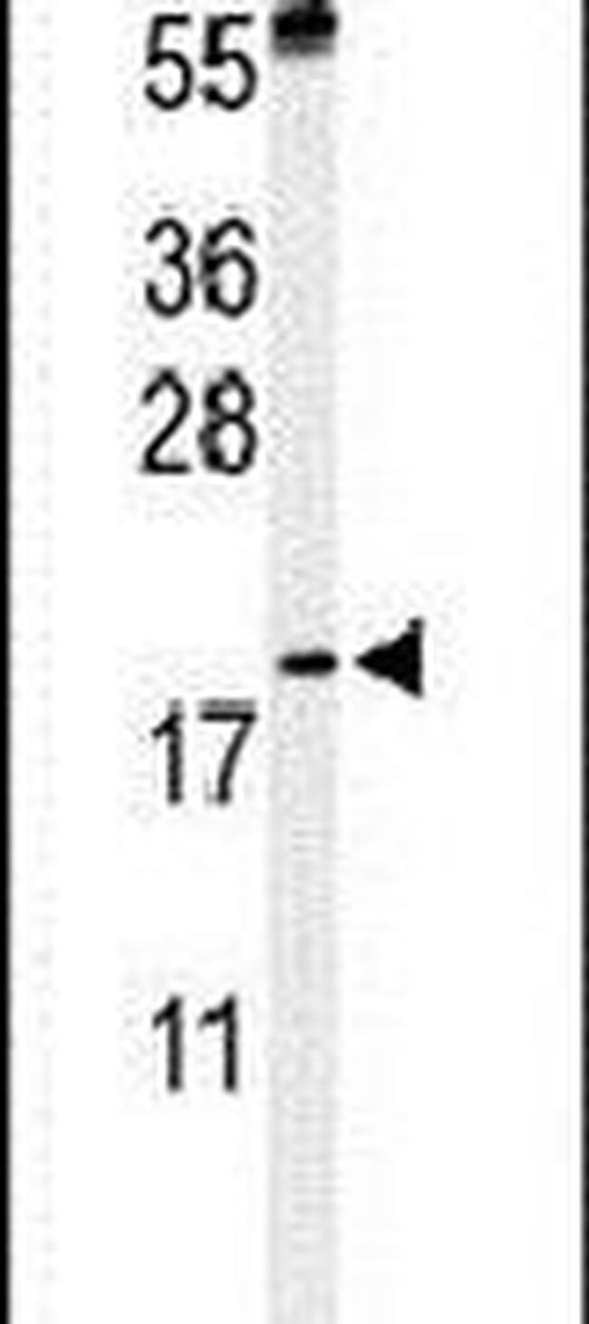 PXMP2 Antibody in Western Blot (WB)