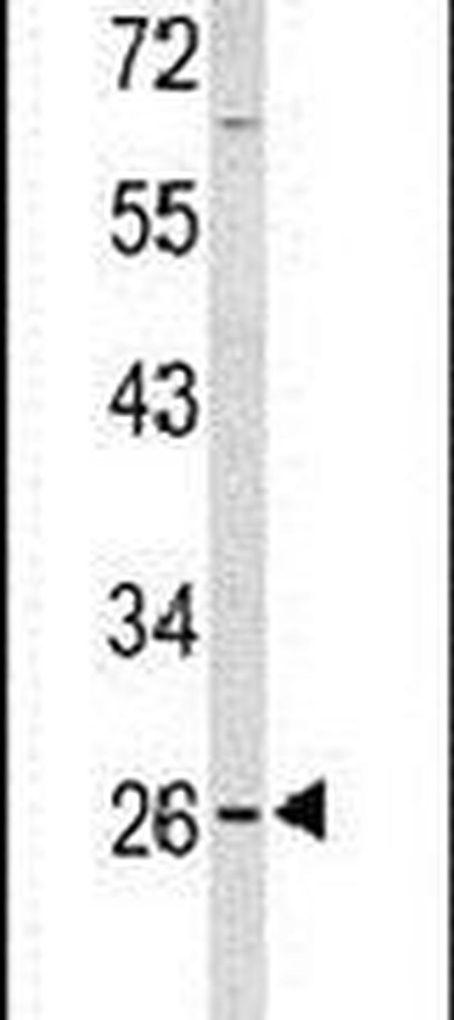 PXMP4 Antibody in Western Blot (WB)