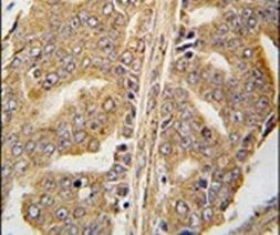 Paxillin Antibody in Immunohistochemistry (IHC)
