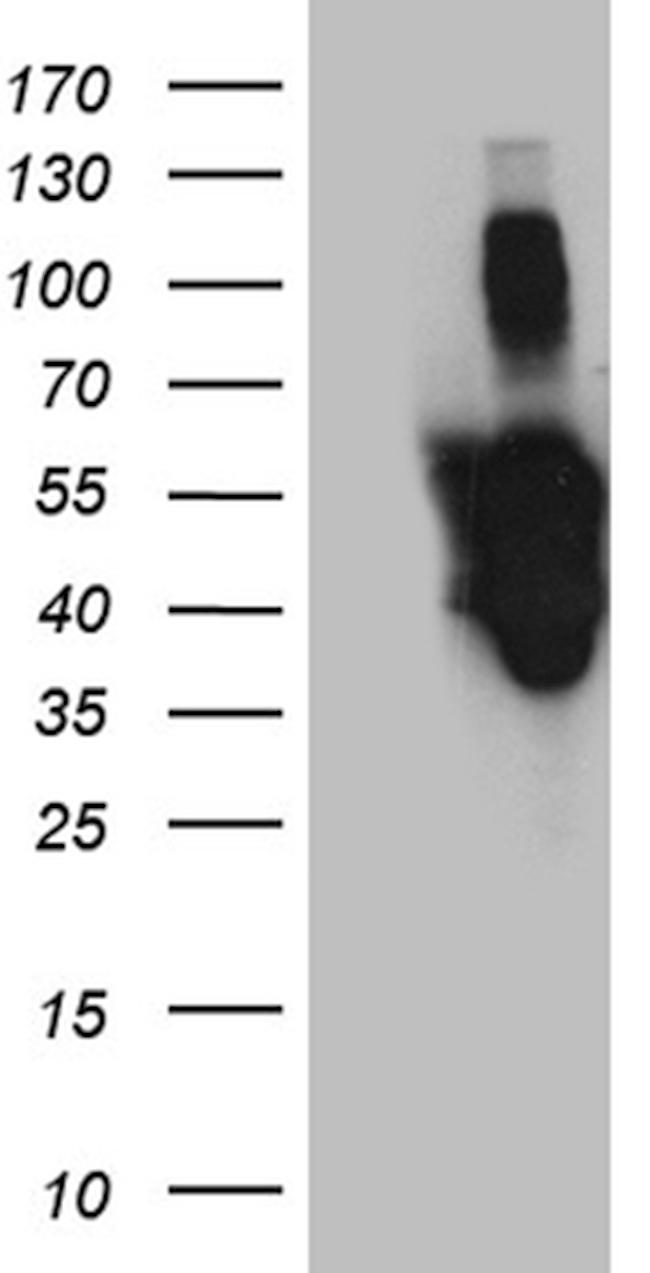 PXN Antibody in Western Blot (WB)