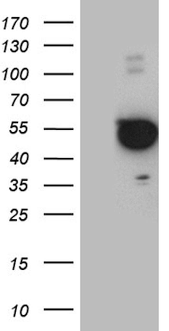 PXN Antibody in Western Blot (WB)