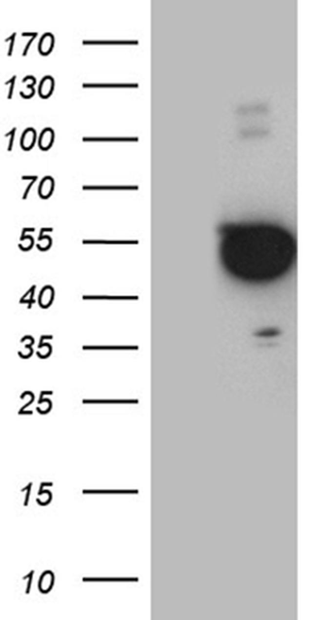 PXN Antibody in Western Blot (WB)