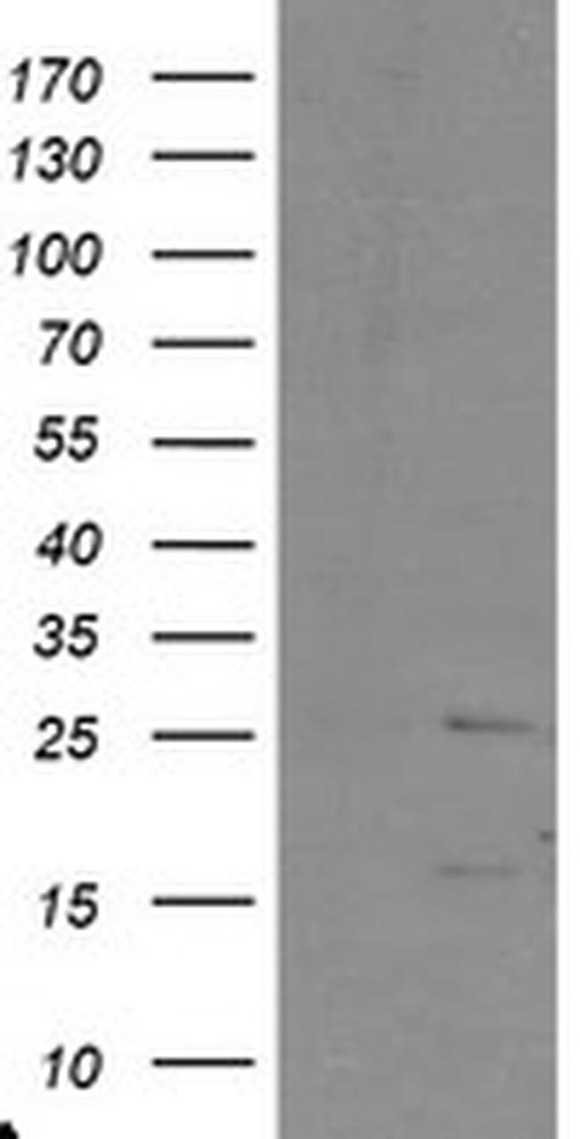 PYCARD Antibody in Western Blot (WB)