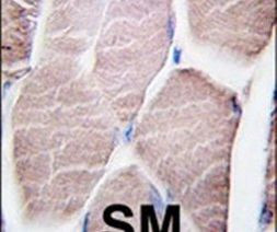 PYGM Antibody in Immunohistochemistry (IHC)