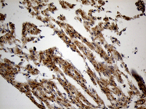 PYGM Antibody in Immunohistochemistry (Paraffin) (IHC (P))