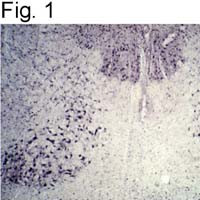 Parkin Antibody in Immunohistochemistry (IHC)