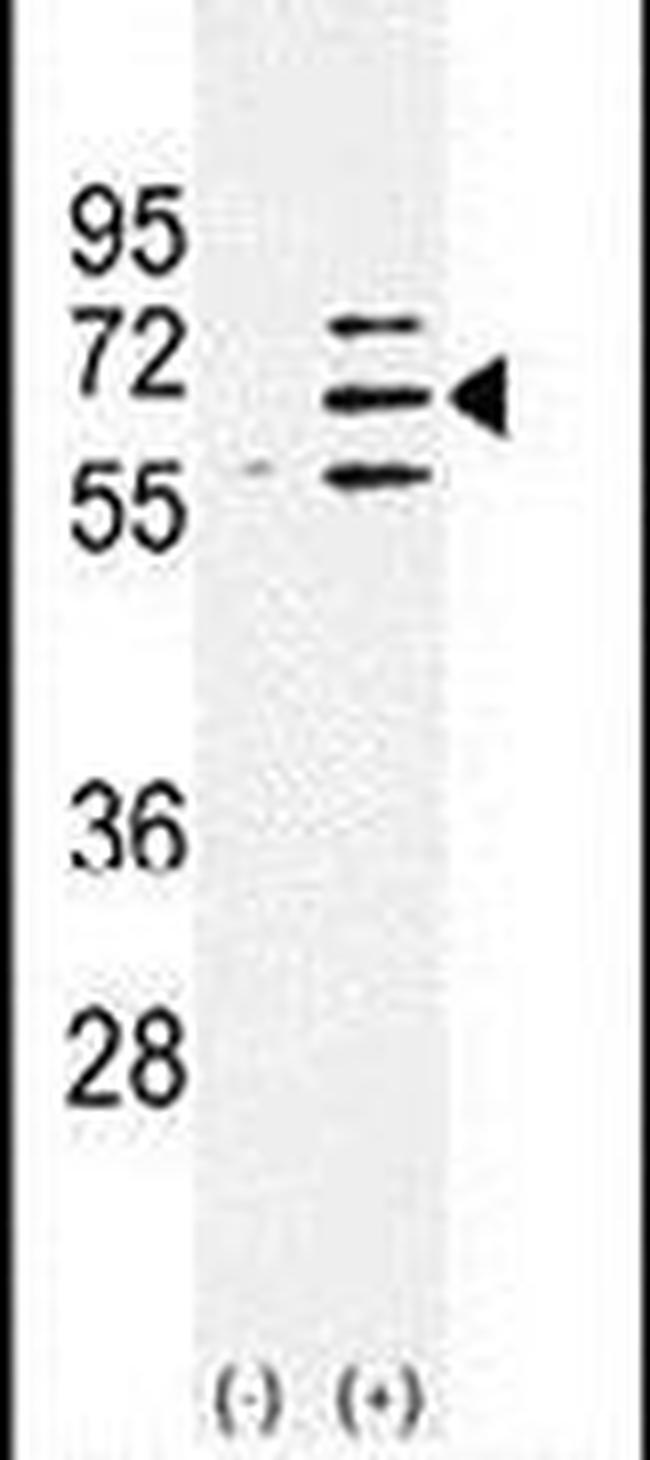 PARP6 Antibody in Western Blot (WB)