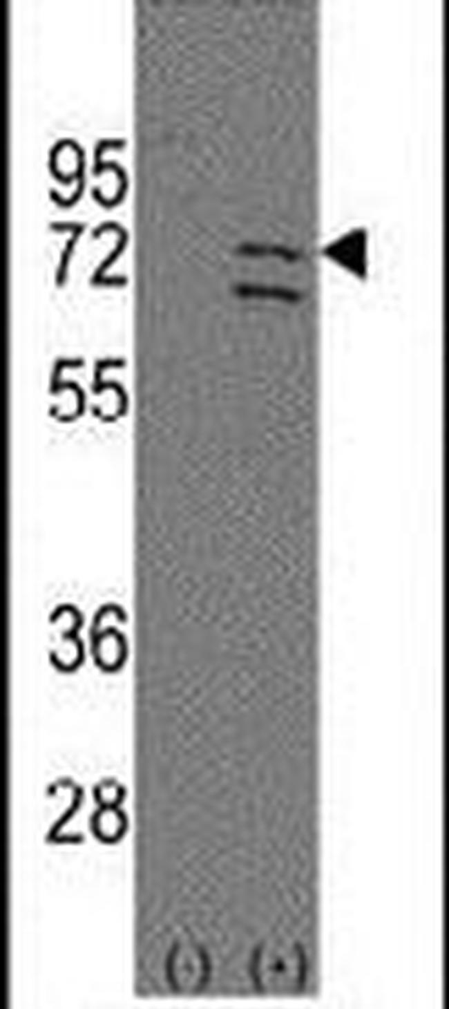PARP6 Antibody in Western Blot (WB)