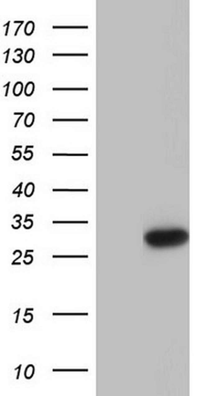 Patched1 Antibody in Western Blot (WB)
