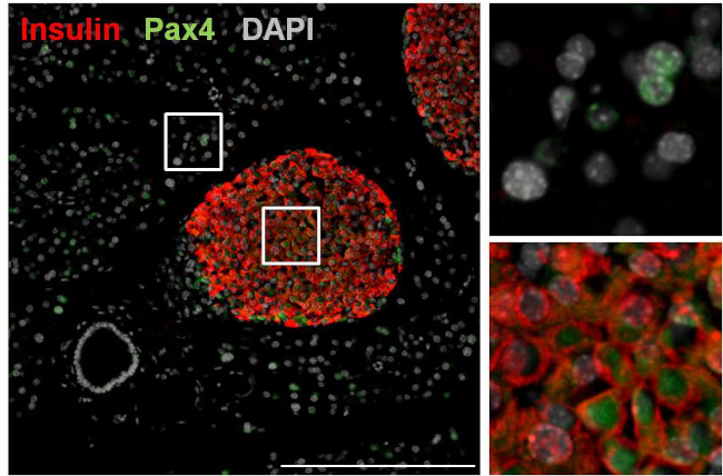 PAX4 Antibody in Immunohistochemistry (IHC)