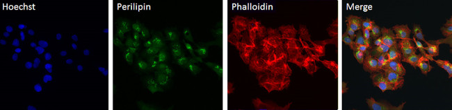 Perilipin 1 Antibody in Immunocytochemistry (ICC/IF)