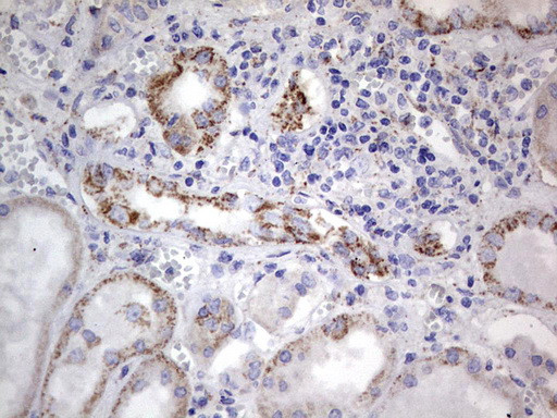 Periostin Antibody in Immunohistochemistry (Paraffin) (IHC (P))