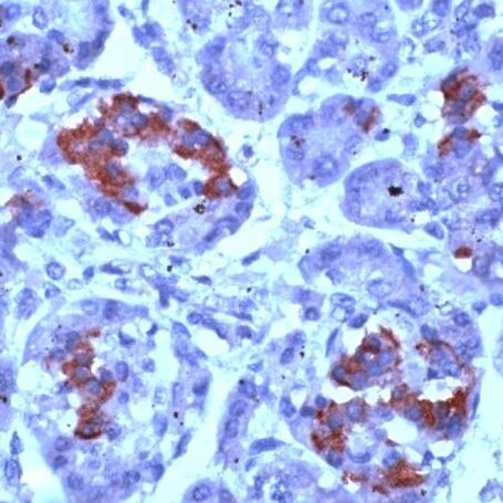 PMP22 Antibody in Immunohistochemistry (IHC)