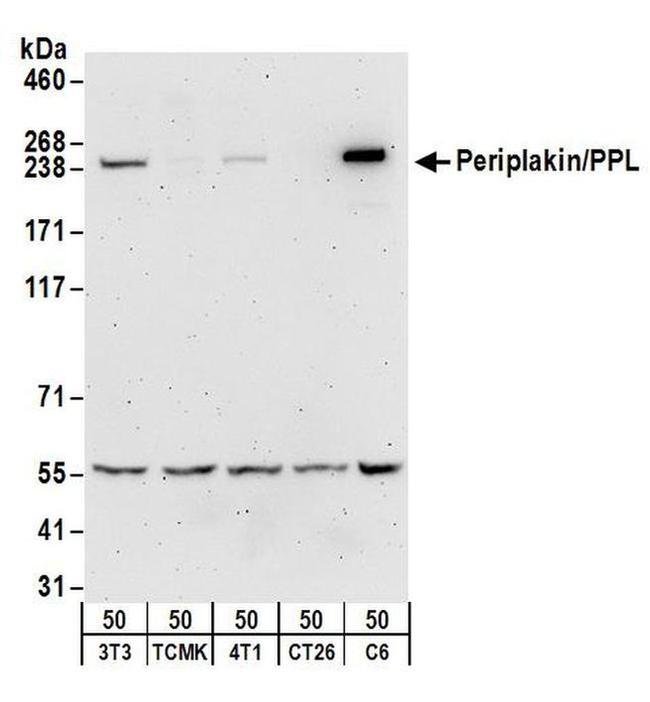 Periplakin/PPL Polyclonal Antibody (A301005A)