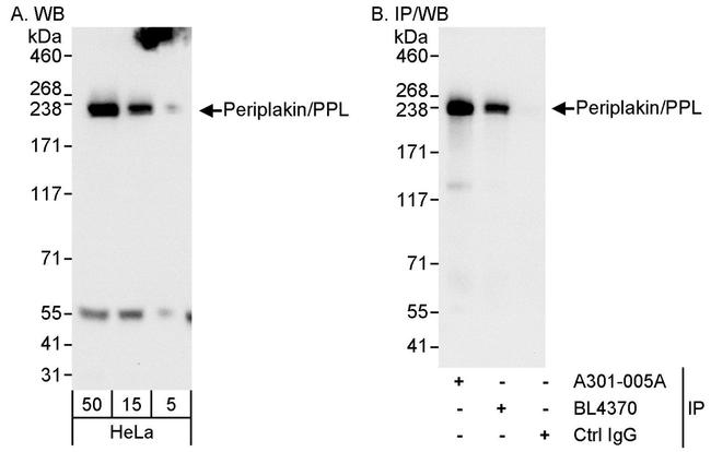 Periplakin/PPL Polyclonal Antibody (A301-005A)