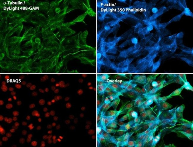 Phalloidin Control in Immunocytochemistry (ICC/IF)