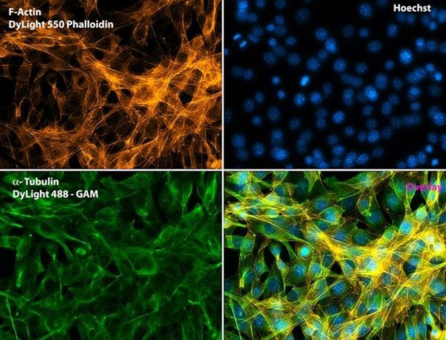Phalloidin Control in Immunocytochemistry (ICC/IF)