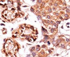 Phospho-c-Abl (Tyr412) Antibody in Immunohistochemistry (IHC)