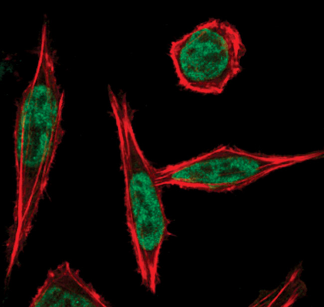 Phospho-ATF2 (Thr71) Antibody in Immunocytochemistry (ICC/IF)