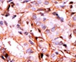 Phospho-BACE1 (Ser498) Antibody in Immunohistochemistry (IHC)
