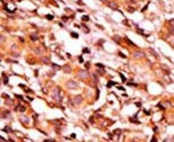 Phospho-BAD (Ser134) Antibody in Immunohistochemistry (IHC)