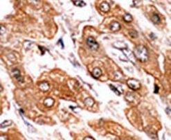 Phospho-BIK (Thr33) Antibody in Immunohistochemistry (IHC)