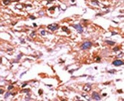 Phospho-Cdc25A (Ser124) Antibody in Immunohistochemistry (IHC)