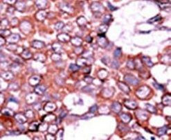 Phospho-Cdc25A (Ser75) Antibody in Immunohistochemistry (IHC)