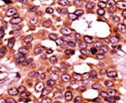Phospho-Cdc6 (Ser54) Antibody in Immunohistochemistry (IHC)