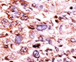 Phospho-CHK1 (Ser280) Antibody in Immunohistochemistry (IHC)