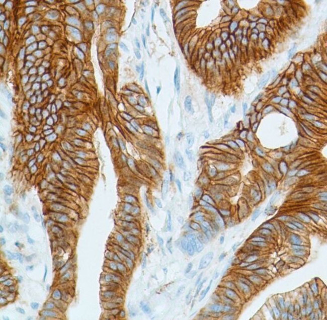 Phospho-Girdin (Tyr1765) Antibody in Immunohistochemistry (IHC)