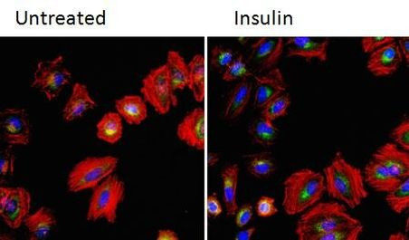 Phospho-GSK3 alpha/beta (Ser9, Ser21) Antibody in Immunocytochemistry (ICC/IF)