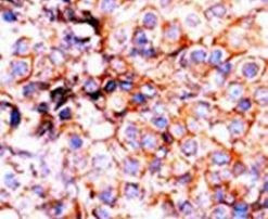 Phospho-Histone H3 (Ser10) Antibody in Immunohistochemistry (IHC)