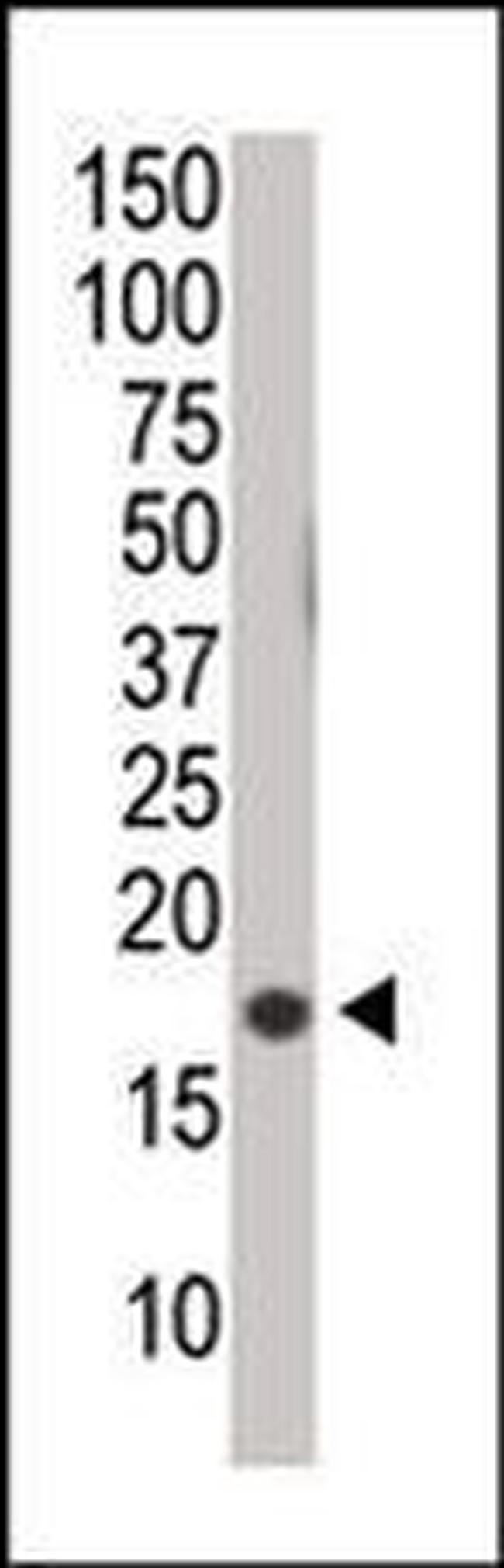 Phospho-Histone H3 (Ser10) Antibody in Western Blot (WB)